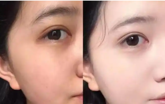 Glutathione uses | Shaanxi BLOOM Tech Co., Ltd Glutathione uses | Shaanxi BLOOM Tech Co., Ltd