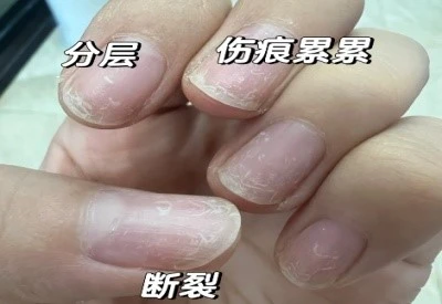 Fish collagen Dense nail cuticle fiber structure | Shaanxi BLOOM Tech Co., Ltd Fish collagen Dense nail cuticle fiber structure | Shaanxi BLOOM Tech Co., Ltd